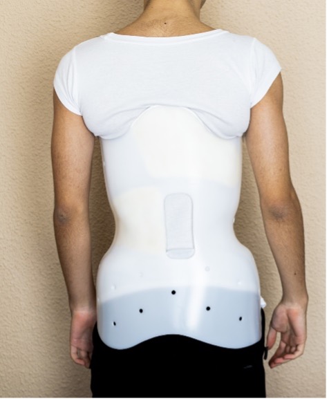 An orthotic body brace