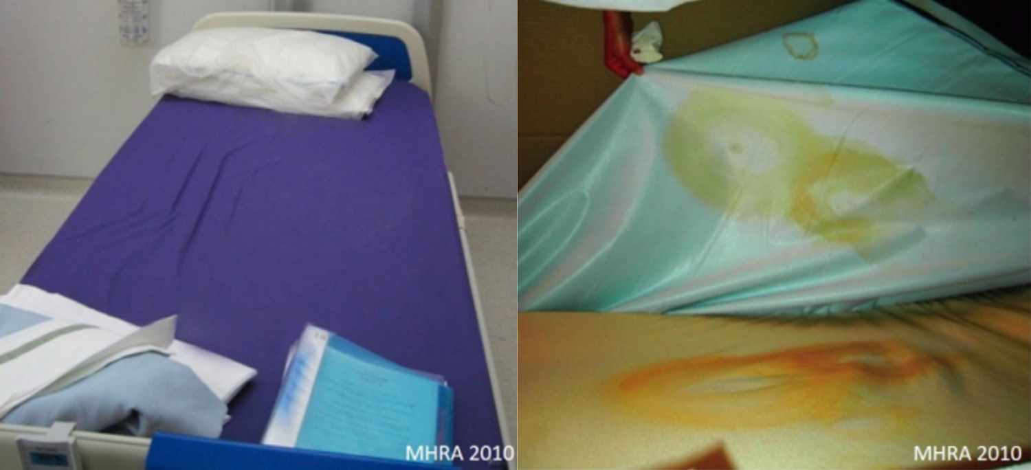 Image of two mattresses showing how they can appear to be clean from above, while contaminated underneath.